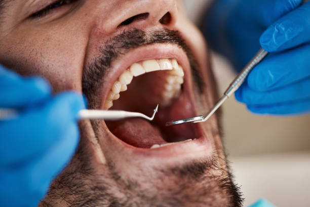 Best Emergency Treatment for Oral Infections in Del City, OK