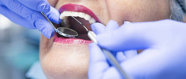 Best Emergency Dental Care for Sports Injuries in Del City, OK